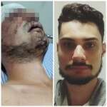 Fotos de Estudante de letras é brutalmente espancado durante roubo em Maringá