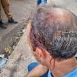 Fotos de Motorista de caminhão é agredido com coronhada na cabeça durante assalto em Sarandi