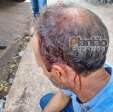 Fotos de Motorista de caminhão é agredido com coronhada na cabeça durante assalto em Sarandi