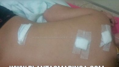 Fotos de Crianças sofrem ataque com arma de chumbinho dentro de escola em Maringá