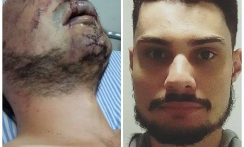 Fotos de Estudante de letras é brutalmente espancado durante roubo em Maringá