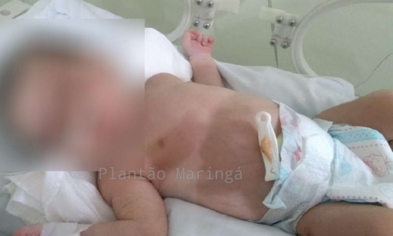 Fotos de Família faz apelo para salvar bebê que nasceu com tumor no estômago em Sarandi