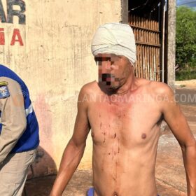 Fotos de Homem é agredido com golpes de foice em Sarandi