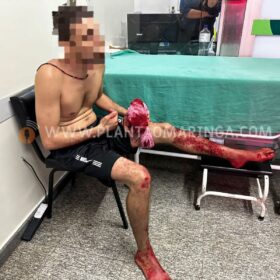 Fotos de Jovem é baleado em frente à casa da mãe em Maringá