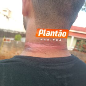 Fotos de Motociclista fica ferido após acidente com fios soltos em Maringá